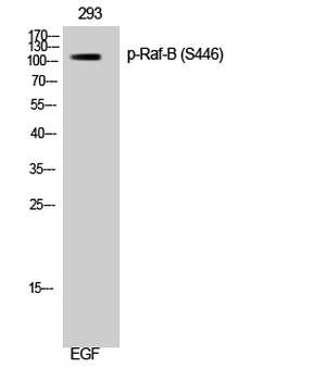 Raf-B (phospho Ser446) Polyclonal Antibody