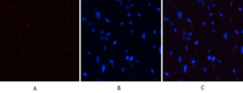 PI 3-kinase p85α (phospho Tyr607) Polyclonal Antibody