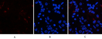 p38 (phospho Tyr323) Polyclonal Antibody