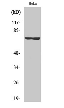 LIMK-1/2 (phospho Thr508/505) Polyclonal Antibody