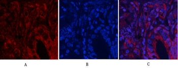Akt (phospho Thr308) Polyclonal Antibody