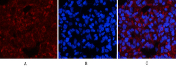 Smad3 (phospho Ser425) Polyclonal Antibody