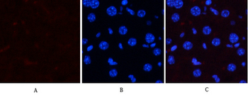 p38 (phospho Thr180/Y182) Polyclonal Antibody