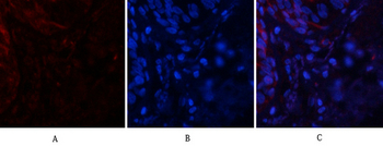 Tau (phospho Ser396) Polyclonal Antibody