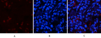 p53 (phospho Thr18) Polyclonal Antibody
