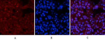 p53 (phospho Ser15) Polyclonal Antibody