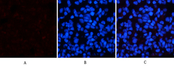 p38 (phospho Thr180) Polyclonal Antibody