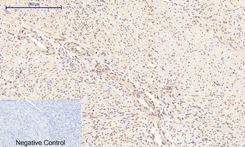 NFκB-p65 (phospho Ser276) Polyclonal Antibody