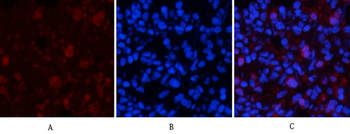 mTOR (phospho Ser2448) Polyclonal Antibody