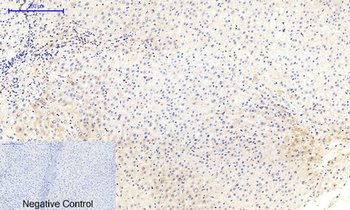 MEK-1/2 (phospho Ser218/222) Polyclonal Antibody