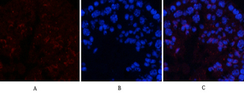 CREB-1 (phospho Ser133) Polyclonal Antibody
