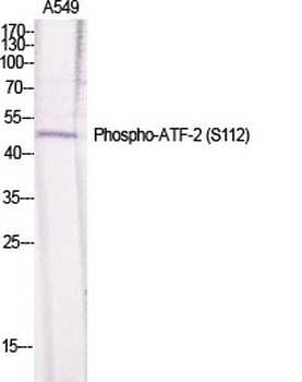 ATF-2 (phospho Ser112) Polyclonal Antibody
