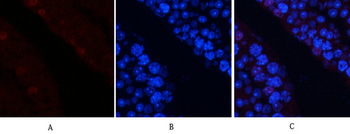 AP-1 (phospho Ser63) Polyclonal Antibody