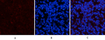 PDGFRα mouse Monoclonal Antibody(7A3)