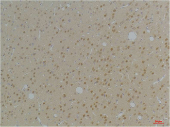 KVβ1 Polyclonal Antibody