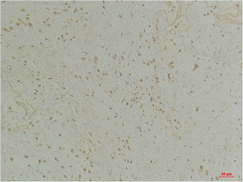 CLIC1 Polyclonal Antibody