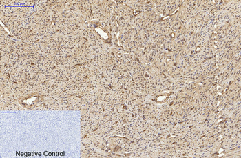 α-tubulin (Acetyl Lys40) Monoclonal Antibody(4A8)