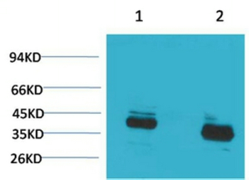 CABP Polyclonal Antibody