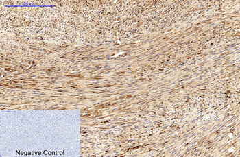 MICU1 Monoclonal Antibody(Mix)