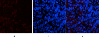 p70 S6 kinase α Polyclonal Antibody