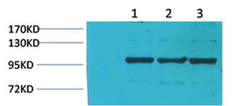 IGFN1 Polyclonal Antibody