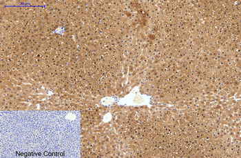 HAO1 Monoclonal Antibody(Mix)