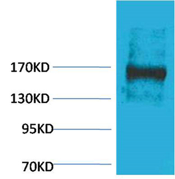 EPG5 Polyclonal Antibody