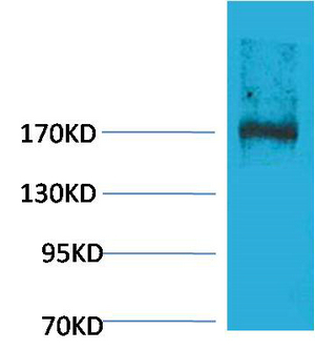 EPG5 Polyclonal Antibody