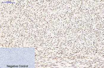 Histone H3 (Tri Methyl Lys79) Monoclonal Antibody(3G3)