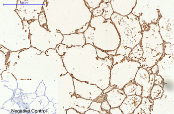 Caspase 9 Monoclonal Antibody(3-20)