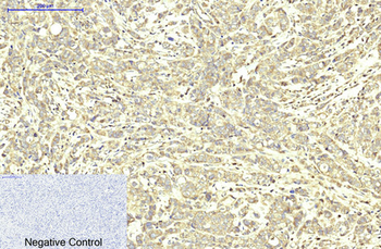 ABCB5 Monoclonal Antibody(11A2)