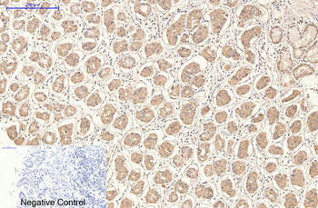 CD21 Monoclonal Antibody(2C5)
