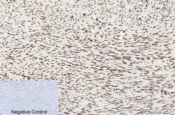 Histone H3 (Acetyl Lys9) Polyclonal Antibody