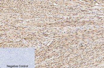 Cleaved-PARP-1 (D214) Polyclonal Antibody