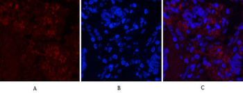 Cleaved-Notch 1 (V1754) Polyclonal Antibody