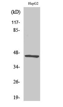 Acrosin Polyclonal Antibody