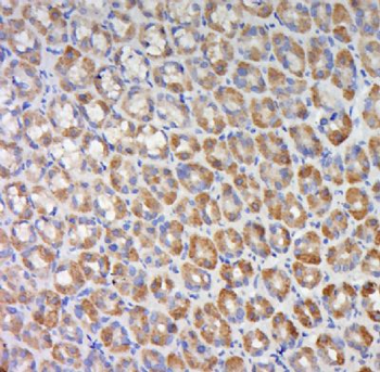 C11ORF77 Polyclonal Antibody