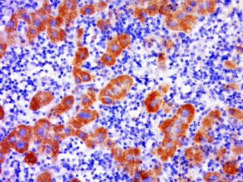 C2orf44 Polyclonal Antibody