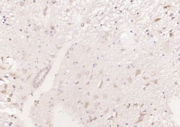 LRSAM1 Polyclonal Antibody