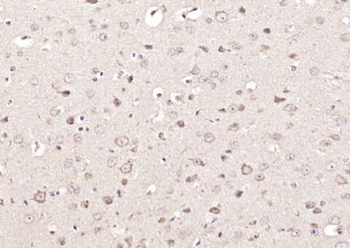 USP9X Polyclonal Antibody