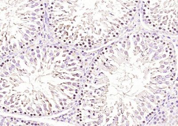 RNF138 Polyclonal Antibody