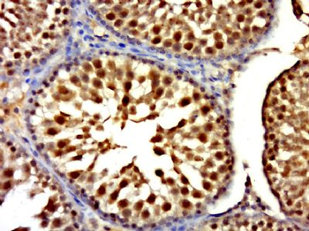 RNF6 Polyclonal Antibody