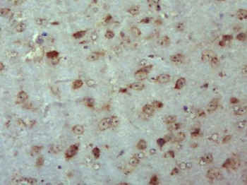 PTPLAD1 Polyclonal Antibody