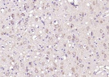 ZNF804A Polyclonal Antibody