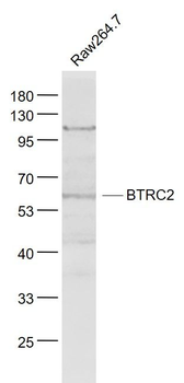 BTRC2 Polyclonal Antibody
