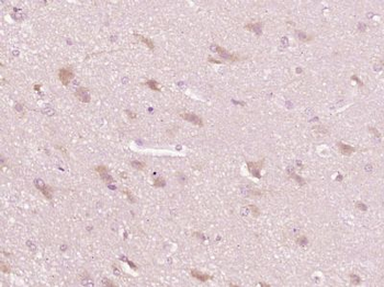 FAM150A Polyclonal Antibody