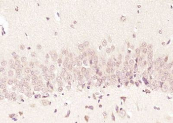 FAM46C Polyclonal Antibody