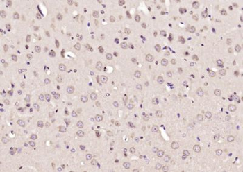 COMMD10 Polyclonal Antibody
