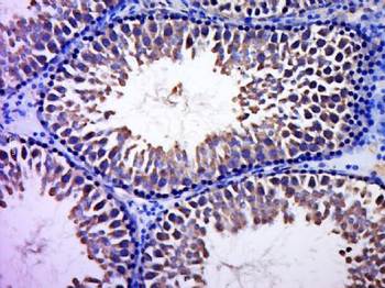CCDC93 Polyclonal Antibody