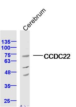 CCDC22 Polyclonal Antibody